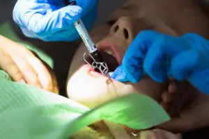 child-to-the-dentist-child-in-the-dental-chair-den-J5T3YLC (1)
