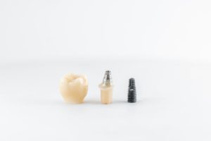 dental-implant-with-screw-and-crown-2021-04-13-04-26-38-utc (1)