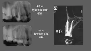 S 22782289